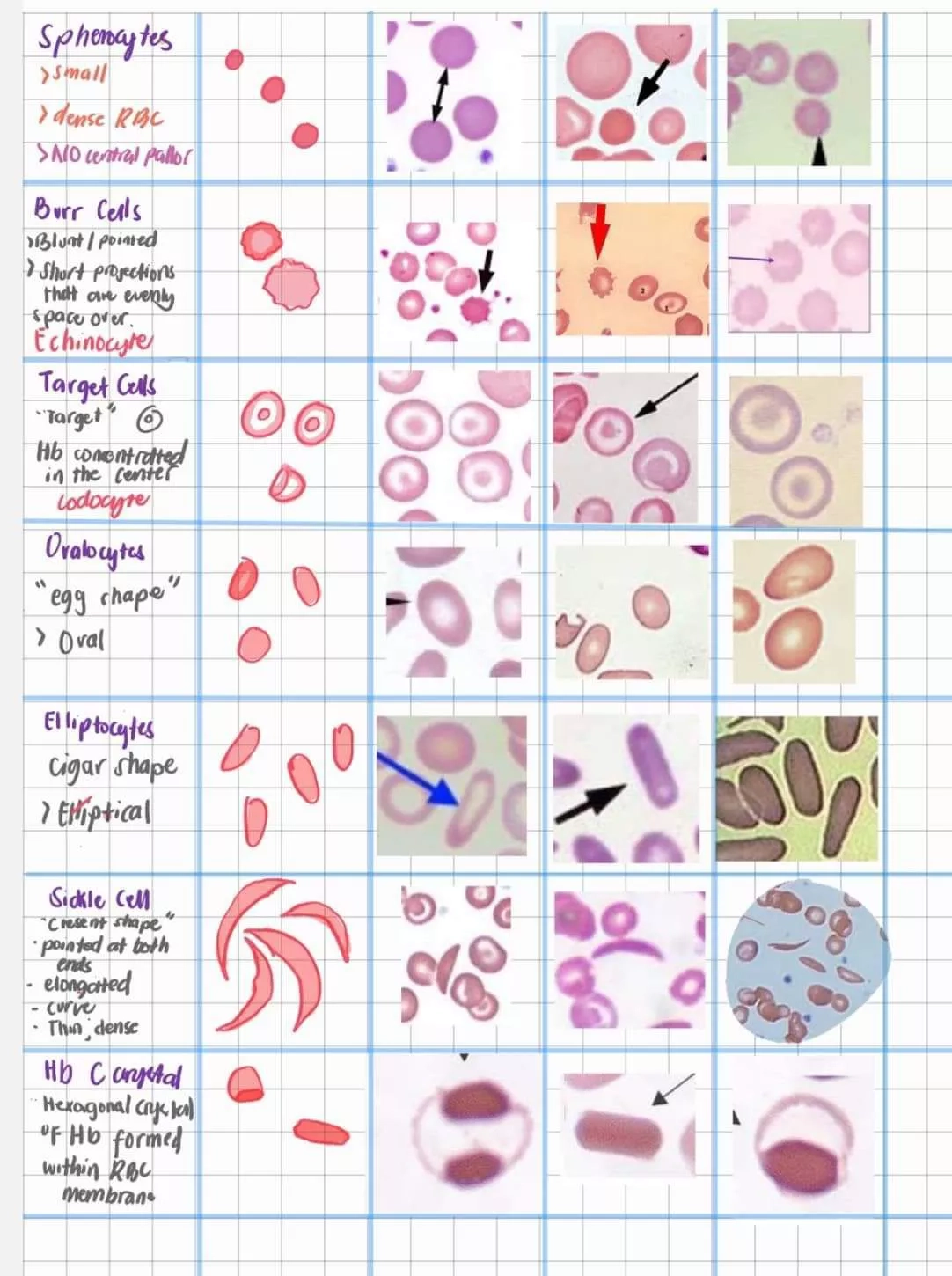 Printable Chart Of Rbc Morphology
