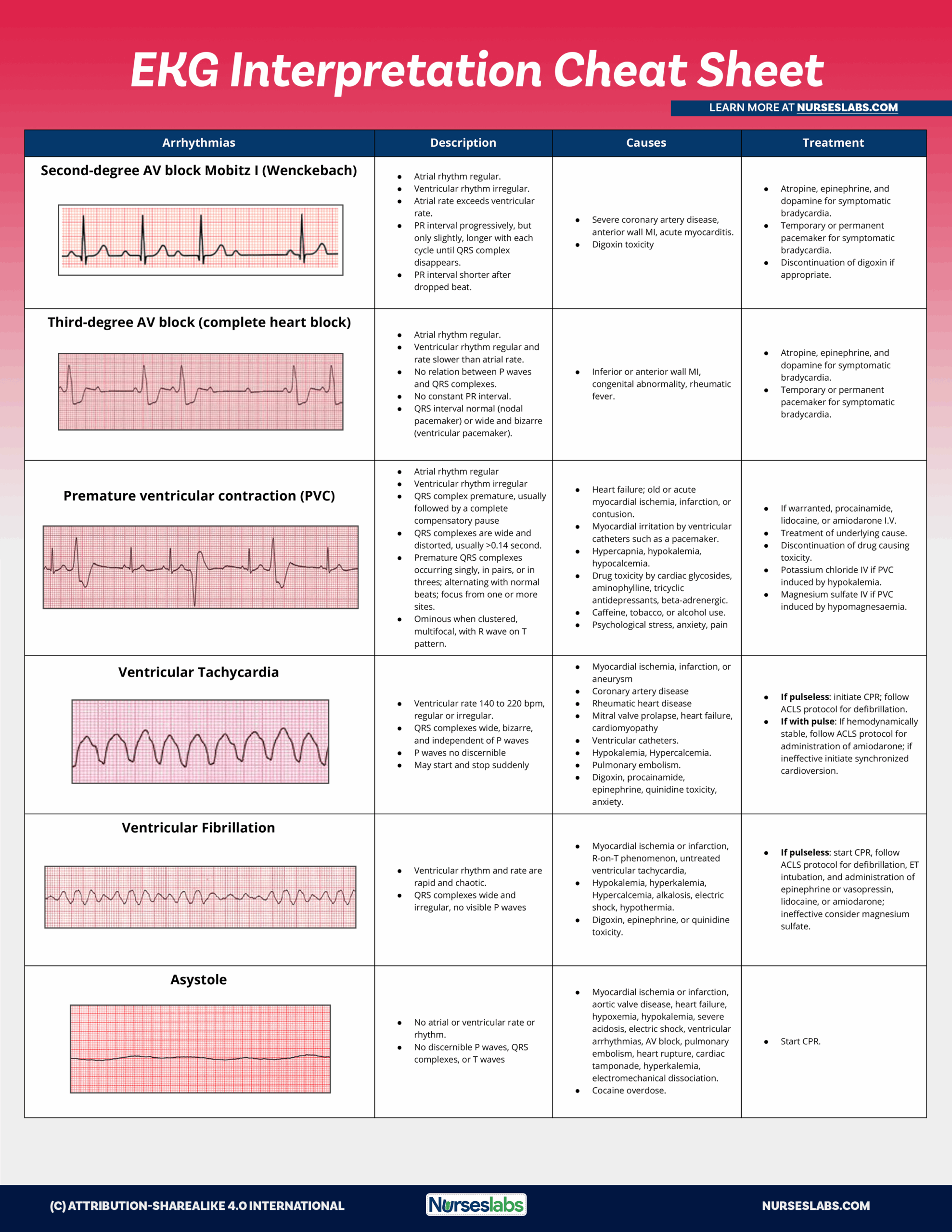 Ekg Strips Printable Quiz