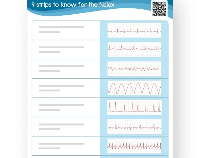EKG Interpretation Rhythms And Strips Cheat Sheet