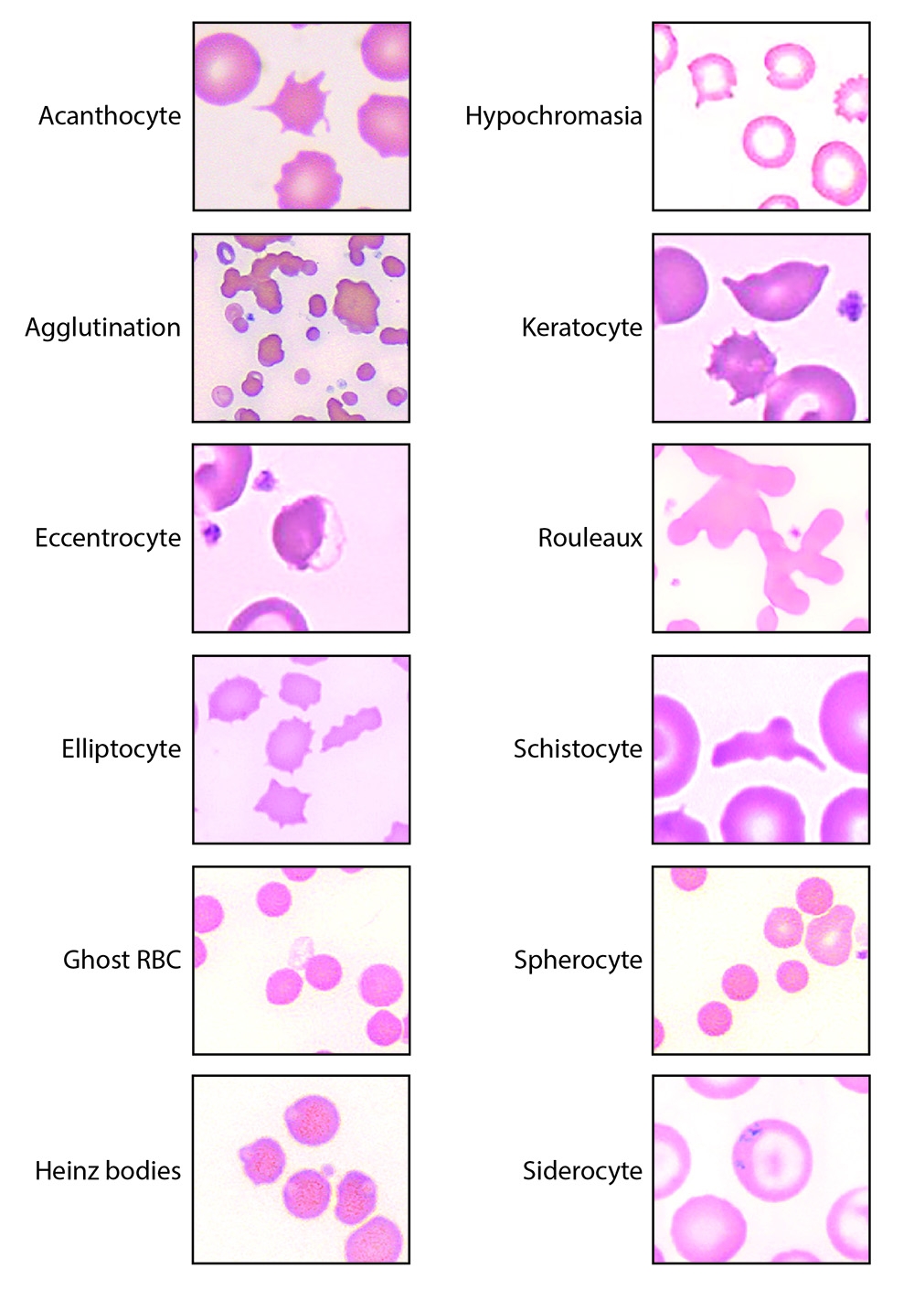 RBC Morphology EClinpath